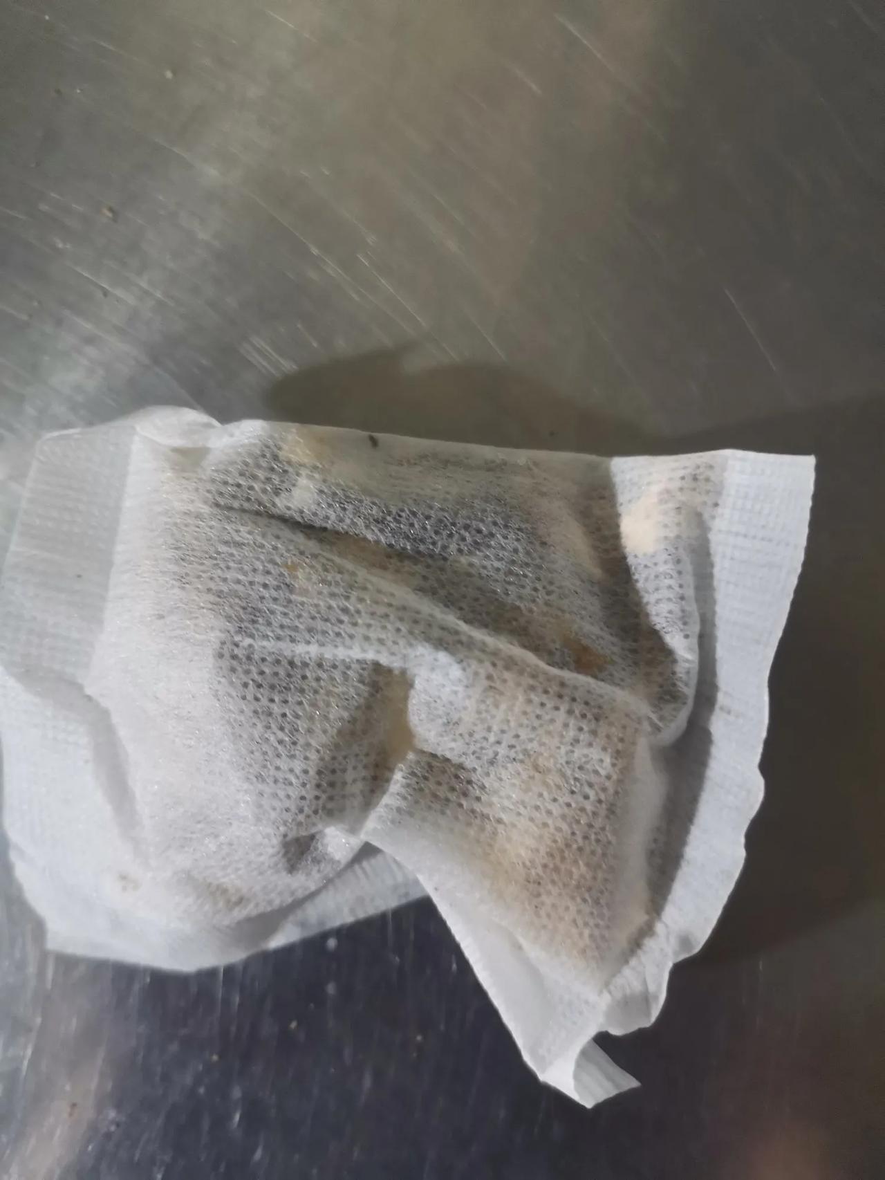 肾病难治，治起来费用非常高，而且一般都治不好。恰恰好相反，肾病预防