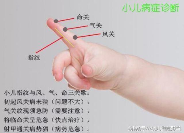 妈妈奶奶必知的3个小儿望诊秘诀, 快收藏啦