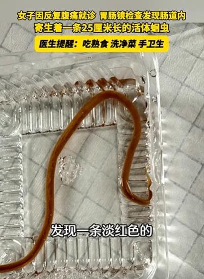 “25厘米长！”浙江金华，40多岁王女士腹痛，她以为是拉肚子，没在意，结果吃药后