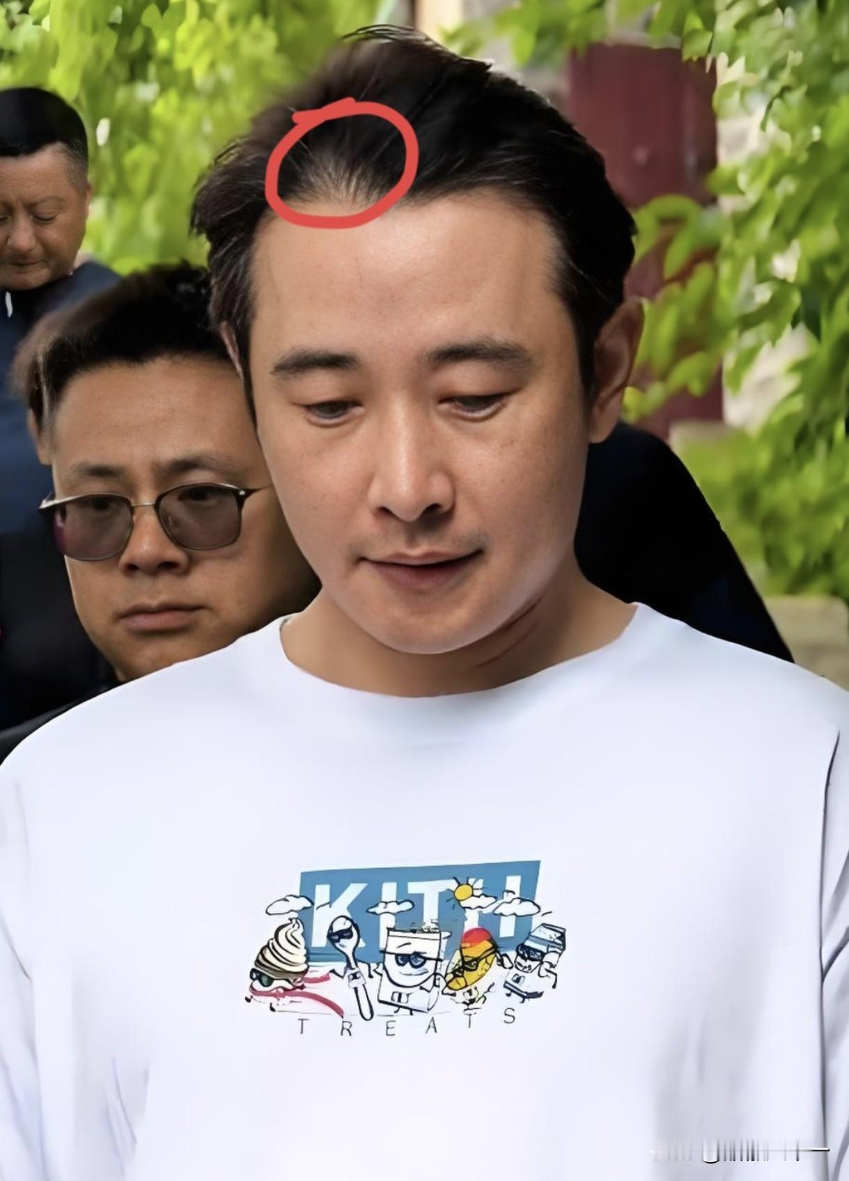 罗晋不上综艺，我佩服，罗晋演技在线，我也佩服，可最令我佩服还是他顶着发际