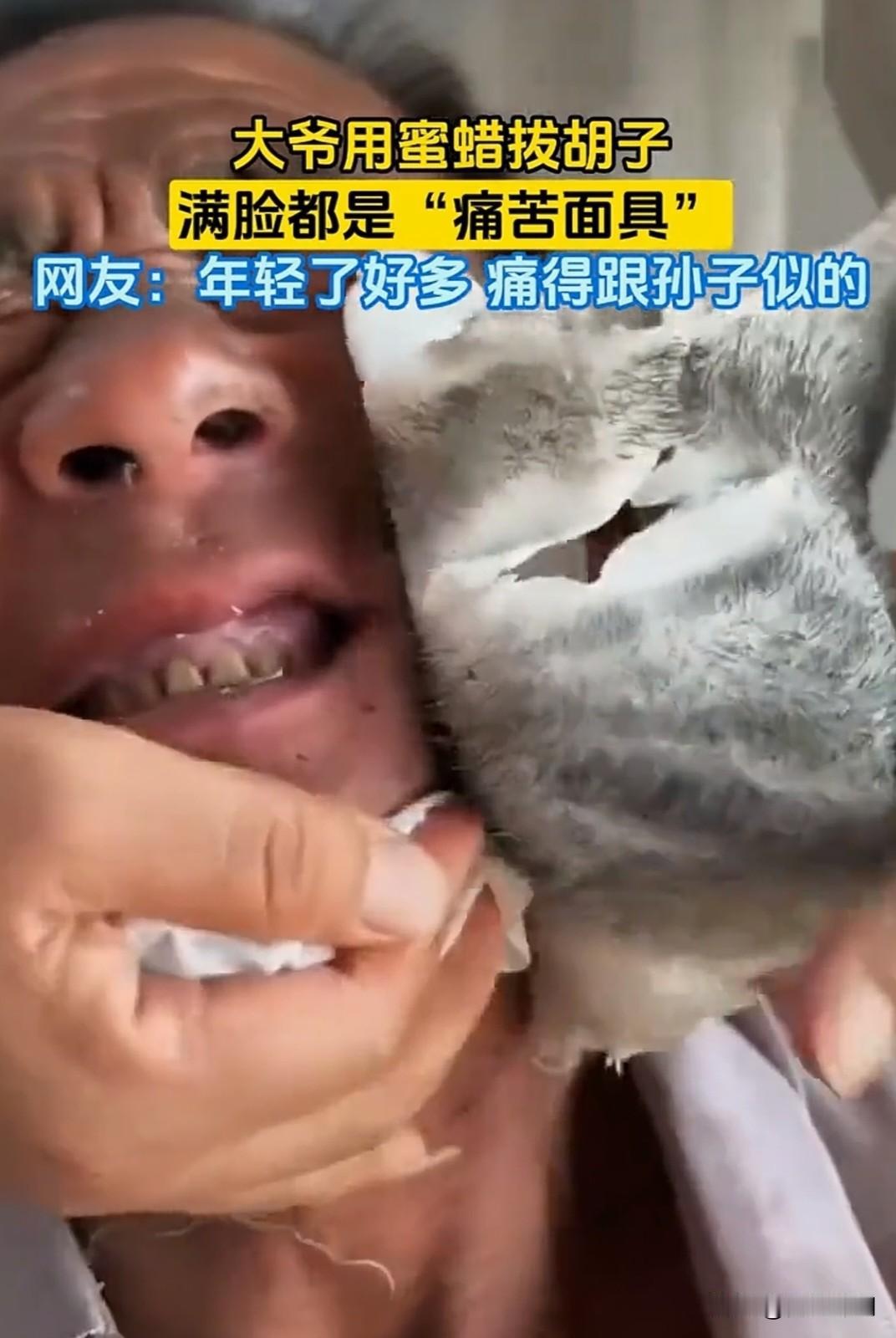 最近网上七旬大爷用蜜蜡拔胡子，那满脸“痛苦面具”可太出圈了。大爷是嫌刮胡子麻烦，