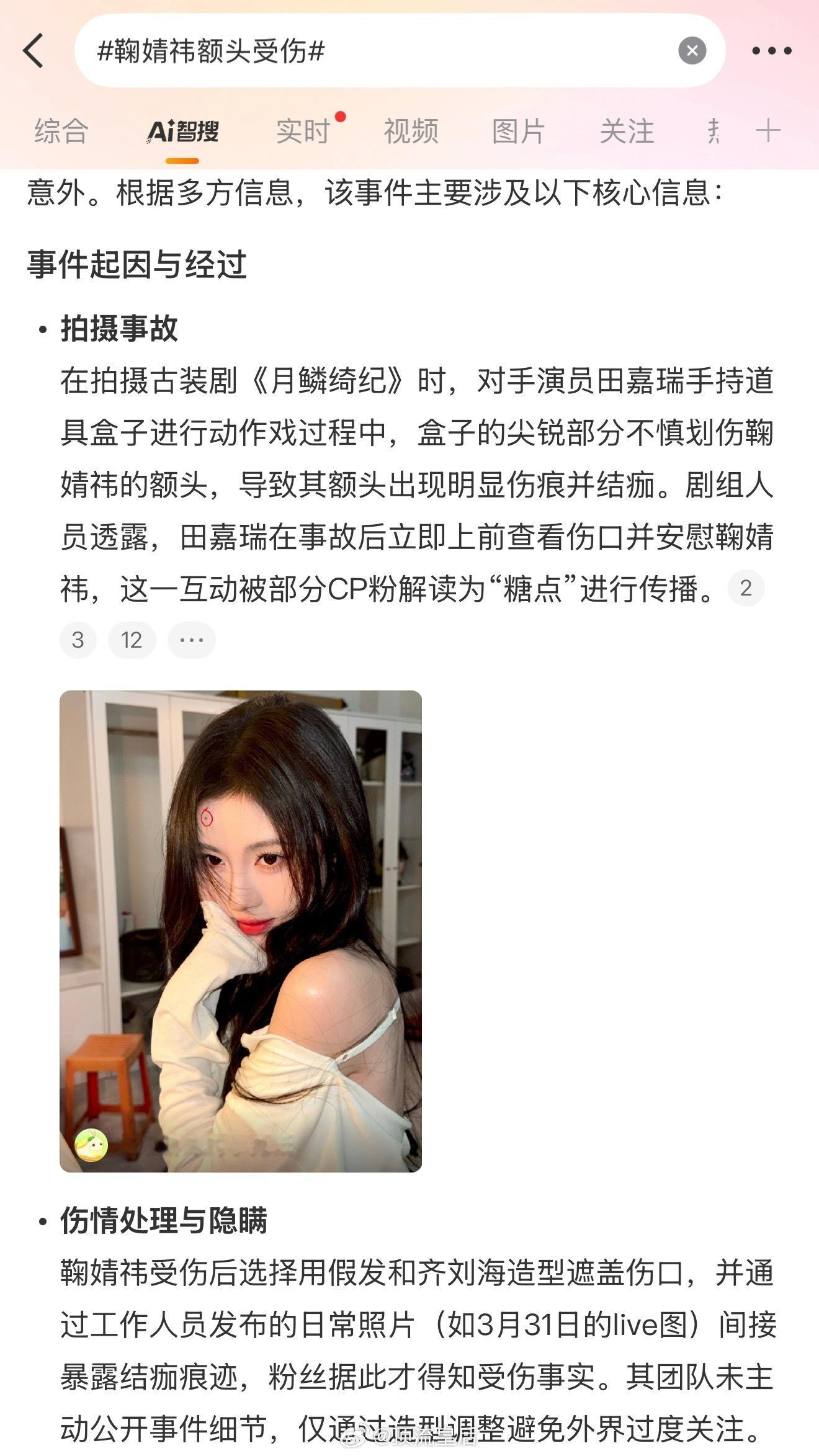 鞠婧祎额头受伤看到智搜总结的经过是这样的，鞠婧祎被划伤也是默默隐瞒伤情，避免被过