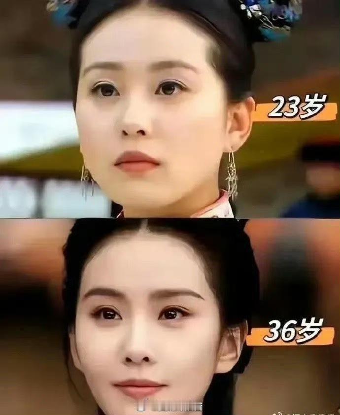 随着年龄增长，不论男女，嘴唇都会逐渐变薄。​​​