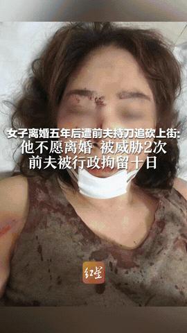 2025年8月，新疆阿克苏，一女子因夫妻矛盾与丈夫离婚，离婚后夫妻双方各自抚养一