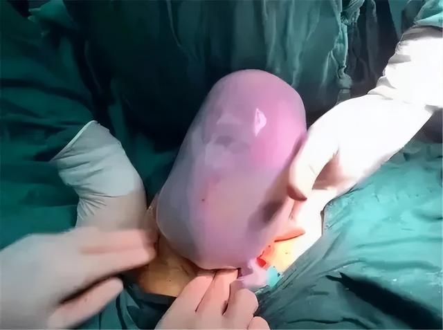 90后孕妈诞下“果冻宝宝”,陪产爸爸吓得不敢抱,医生:恭喜你