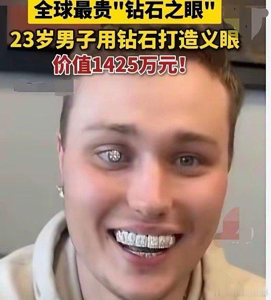 看看这个美国男子的义眼多闪多美，闪闪发光。知道吗，这个年龄只有二十三岁的帅小伙是