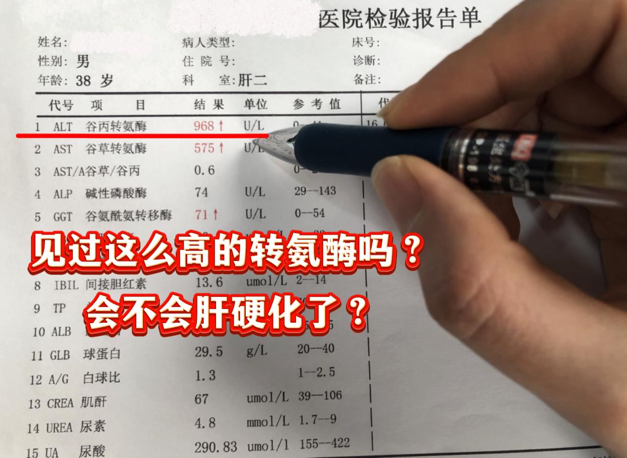 年纪轻轻38岁，转氨酶900多，又是一位山东本地的男子。经过面诊得知...