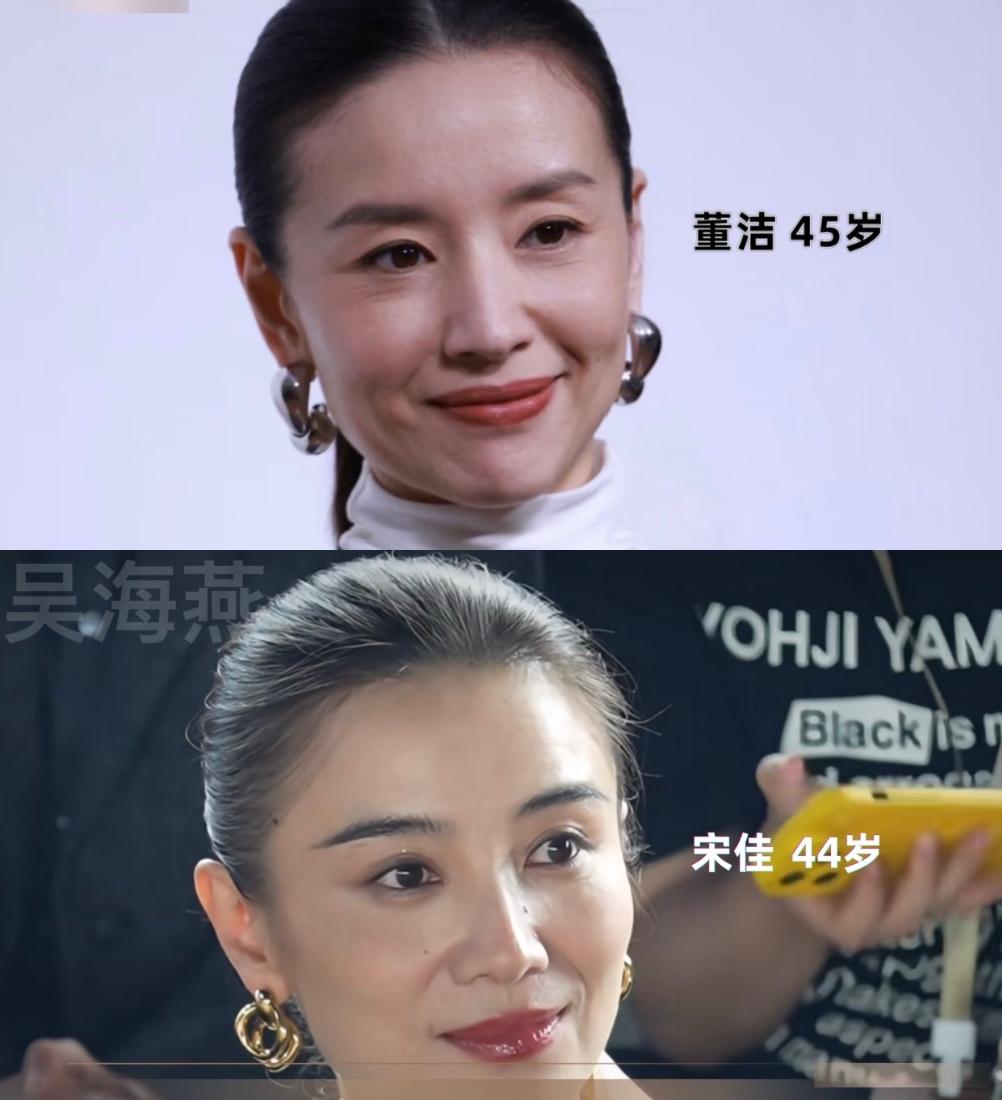 突然发现她俩头型蛮像的，相差一岁但从脸上看董洁可比宋佳老多了，是有两方面原因