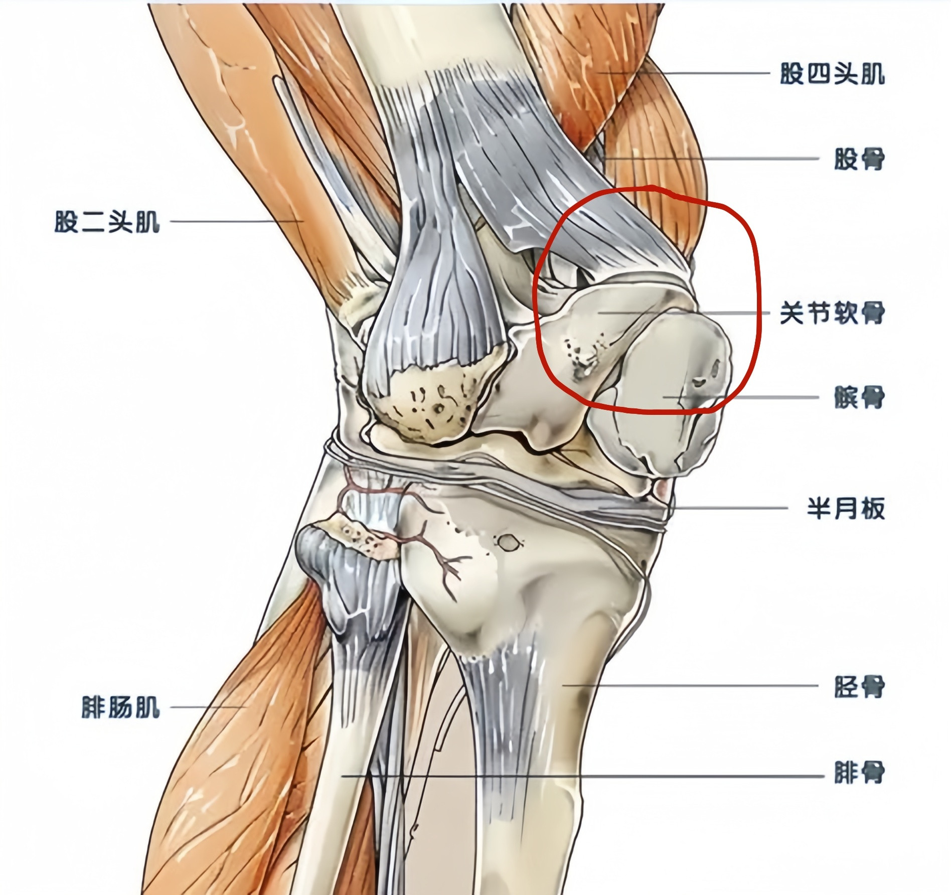 爱德华兹“跑步膝”这个事，有点麻烦啊！说白了就是体重太大，打法太劲爆，膝关节的髌