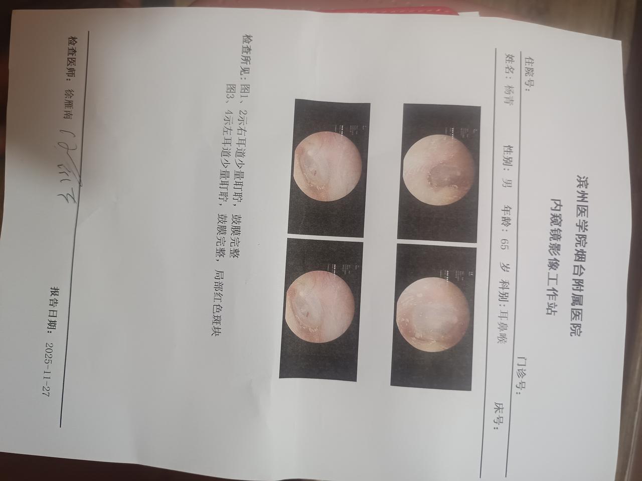 很遗憾，去医院用先进医疗器械一顿检查，没有查出病因。耳鸣至今大概20天，尤其走