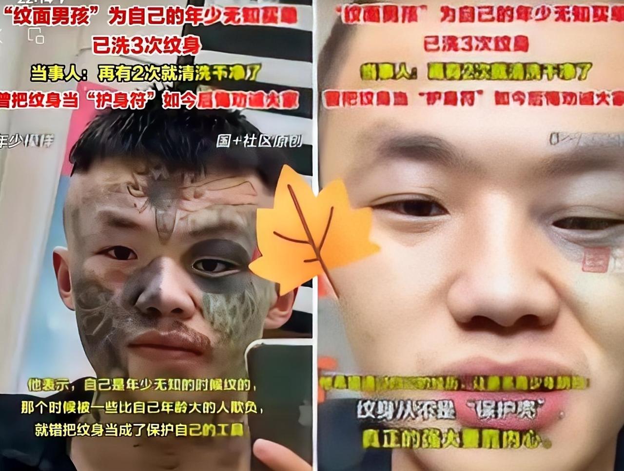 “后悔了吧？”06年出生的广东男孩夏朝勇，正咬牙忍受着第五次激光洗纹身的痛苦。
