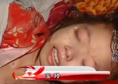2008年，爷爷每天用镊子，从她背上的溃烂处一条条往外捏取蛆虫。十岁的蒋玉玲不流