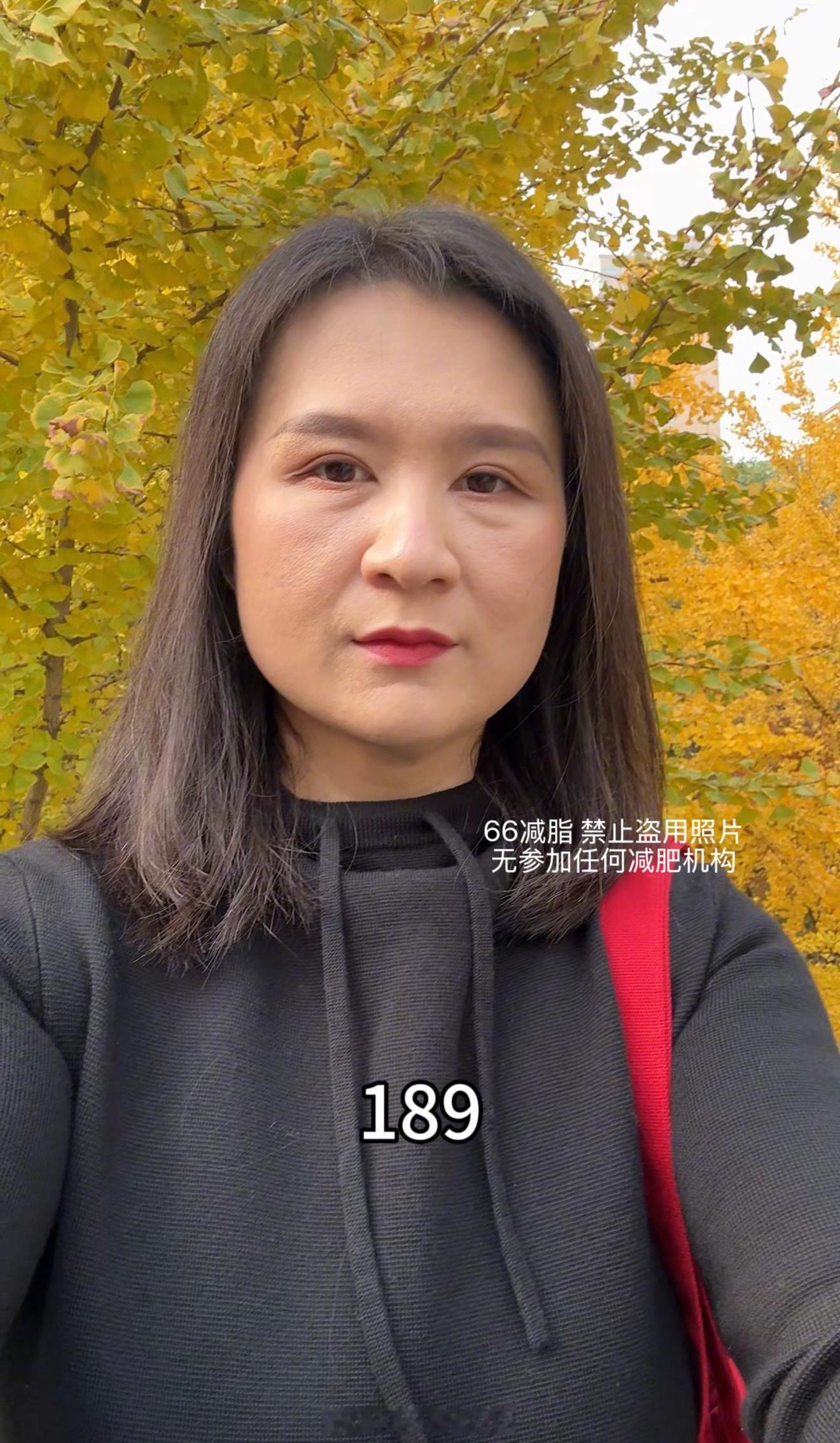 减了150斤的面部变化减肥瘦身