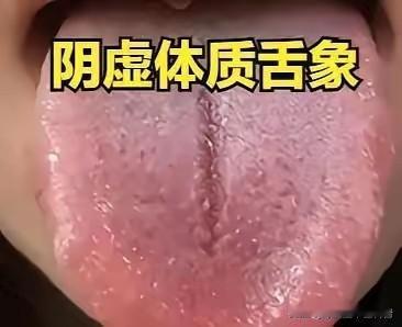 舌质红少苔？别再乱降火！这是阴虚，这样调才能补阴润燥不耗气大家好，我是陈大