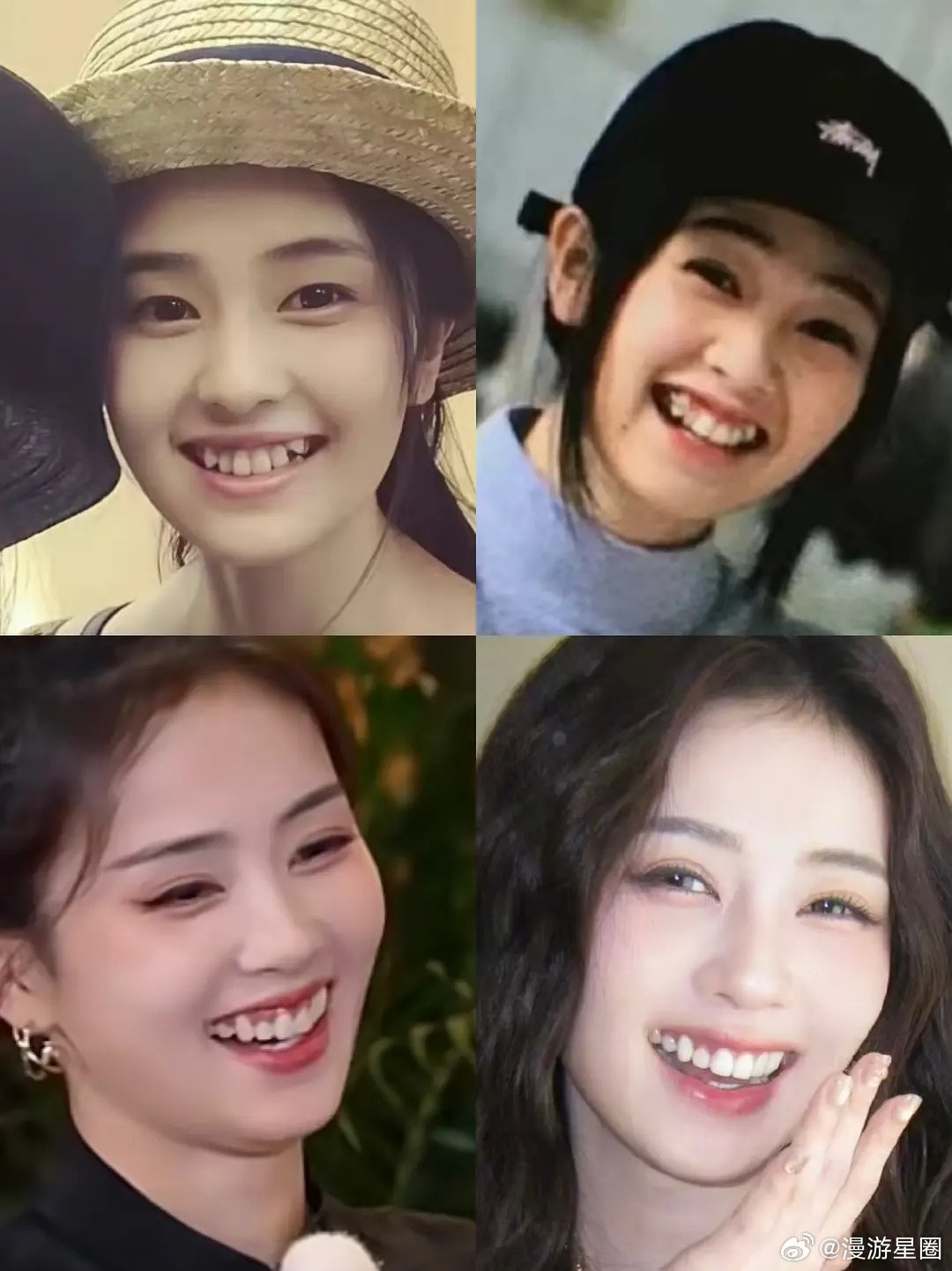 白鹿的牙是怎么变成现在这样的？她也没戴过牙套吧