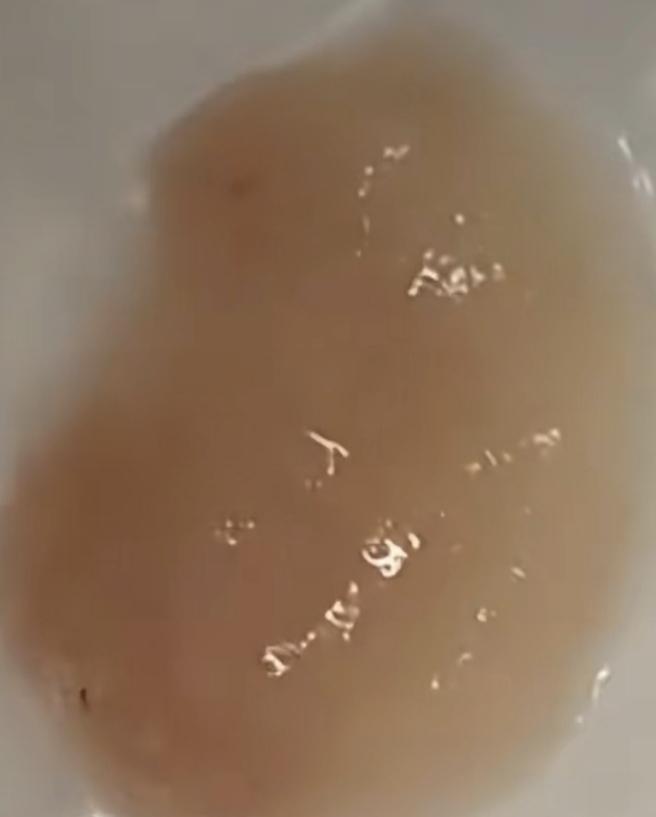 鸡胸肉是的你猜它是啥呀