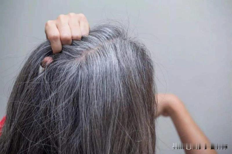 干枯、脱发、白发怎么办?家人们！影视剧里“一夜白头”的桥段，到底是艺术夸张还是