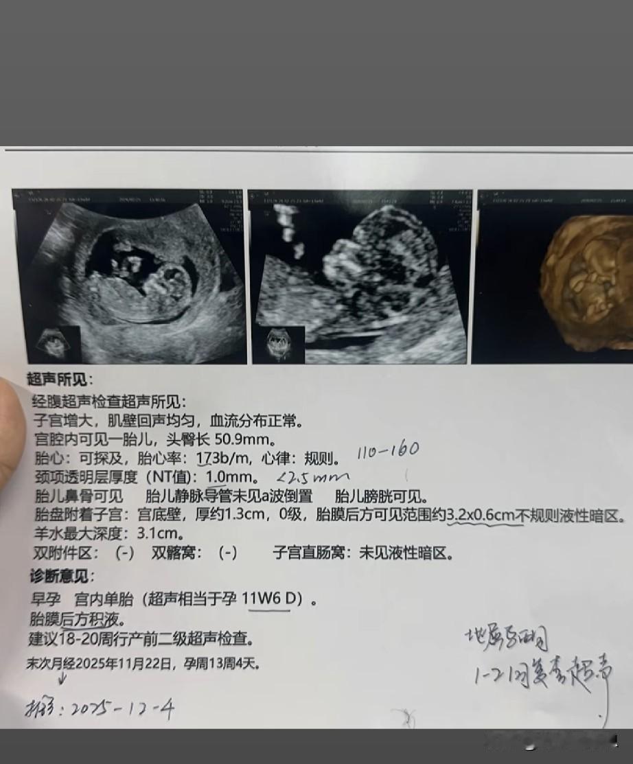 这是我们第一次见面，我就选择用这张照片，也是唯一一张可以看清你的照片，这条怀孕之