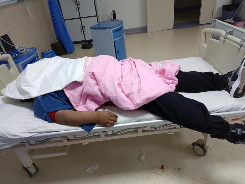 太吓人了！陕西榆林，一41岁男子只是感冒咳嗽，入院检查仅轻微支气管炎症，本以为输