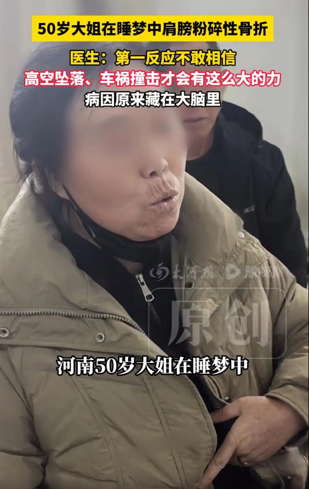 这下解释不清了！河南，一位50岁大姐肩膀粉碎性骨折，来到医院后，医生还以为是被车