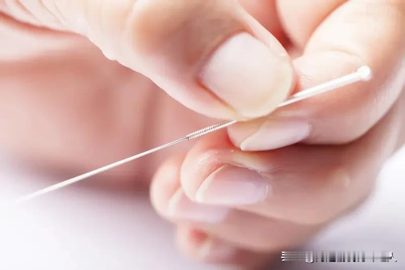 关于针灸意外情况，既然干了这行，我就得把话说明白。如果你真的想通过针灸调理身体