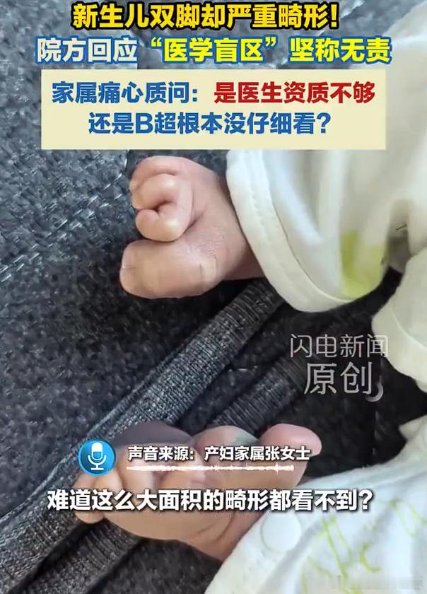 花一万多产检一路绿灯生下来畸形终于看懂产检的边界了：大排畸只排查致命重大畸形，手