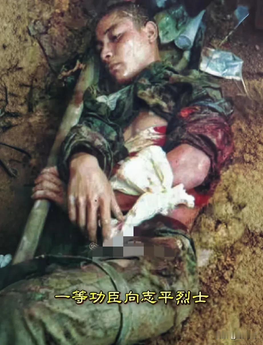 这是一等功臣向志平烈士的遗体，他牺牲时才20岁，风华正茂！1984年，攻打老山