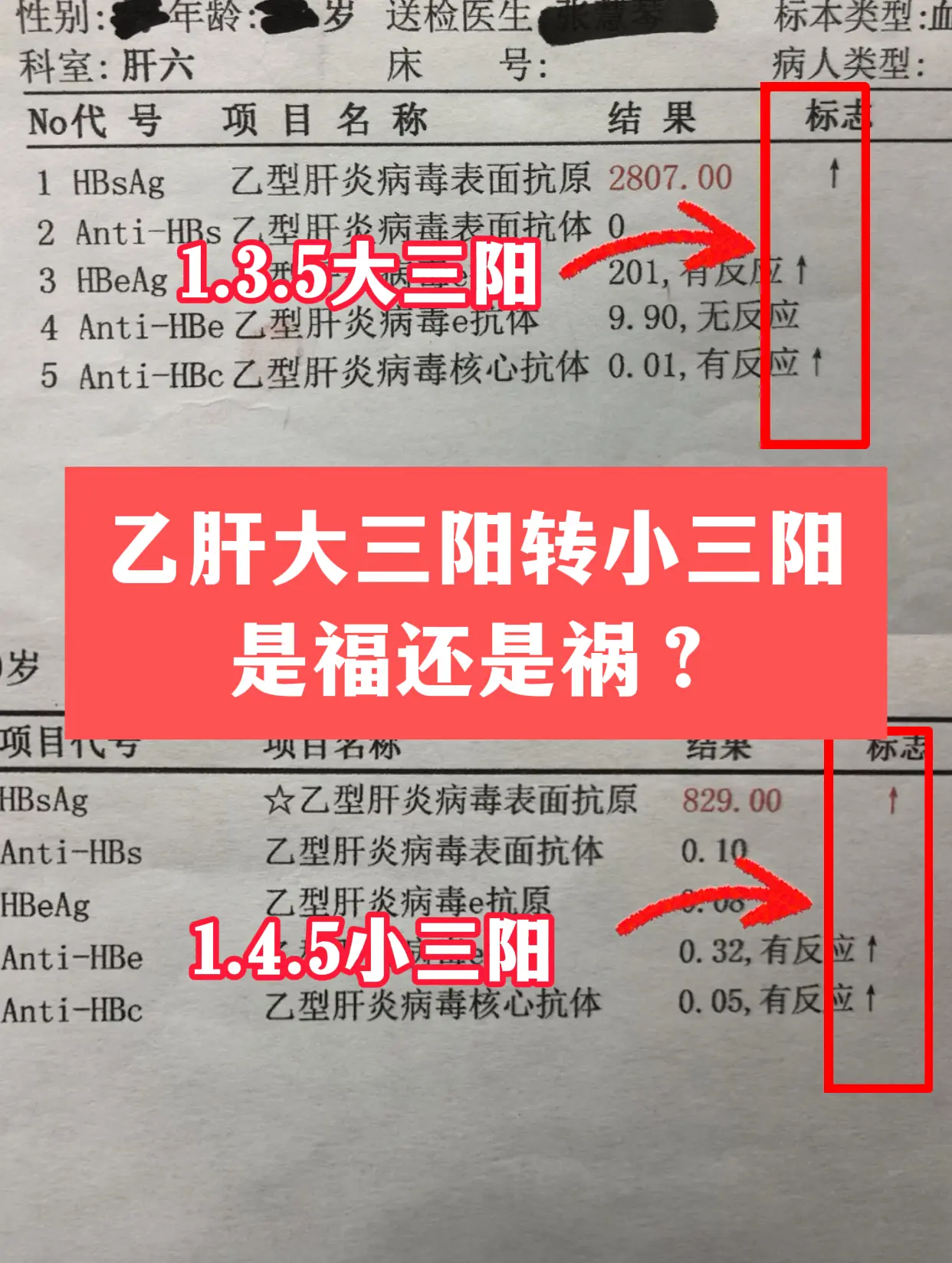 乙肝大三阳转小三阳，多数情况是福：说明病毒复制变缓、传染性降低，肝脏炎...