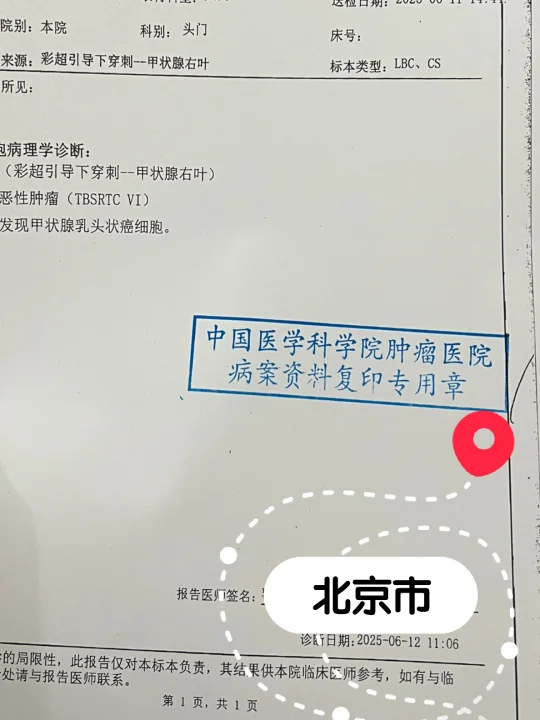 好消息，坏消息。