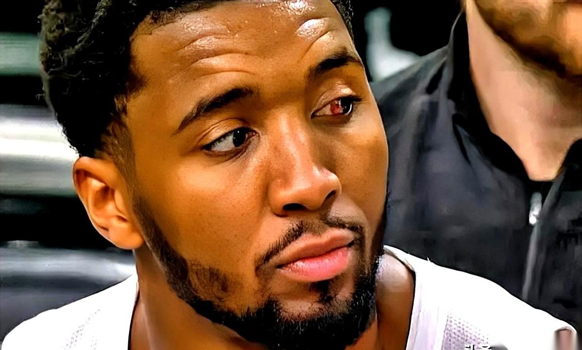 “我左眼……基本上看不见了。”比赛打完，米切尔对着镜头，就这么轻描淡写地说了一