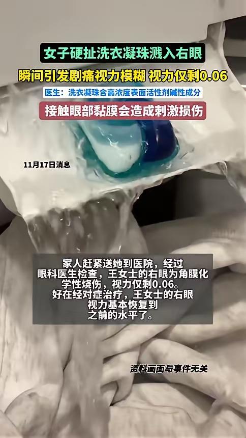 杭州女子手撕洗衣凝珠，直接把右眼“作”到视力0.06！这household必