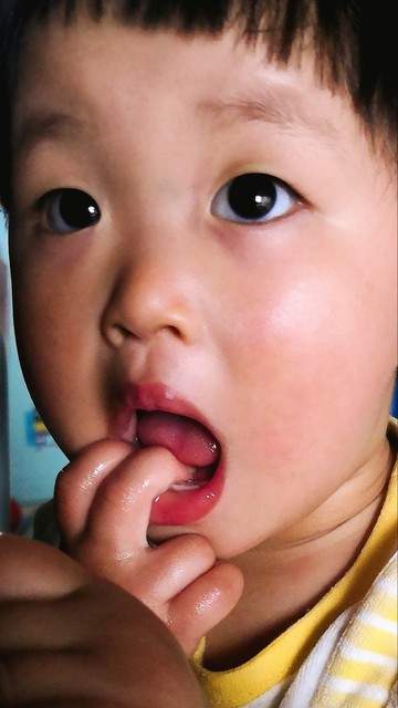孩子总啃指甲? 别当小事, 医生说的这两个后果, 真不是吓唬你