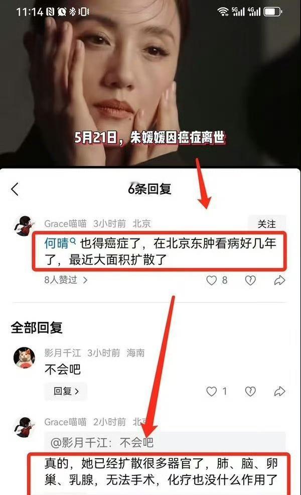 原来朱媛媛去世的时就有人爆料何晴患癌了。何晴因癌症离世今天被网友热议。还有网