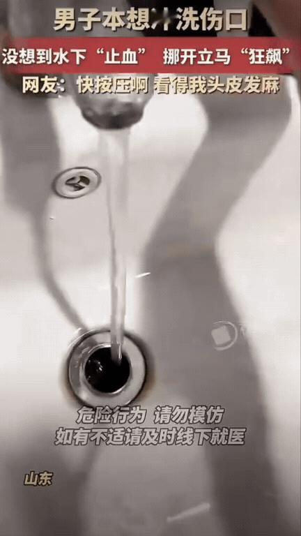 看着都揪心！山东一名男子受伤之后，直接对着水龙头冲洗伤口。本以为冲洗干净就没事，