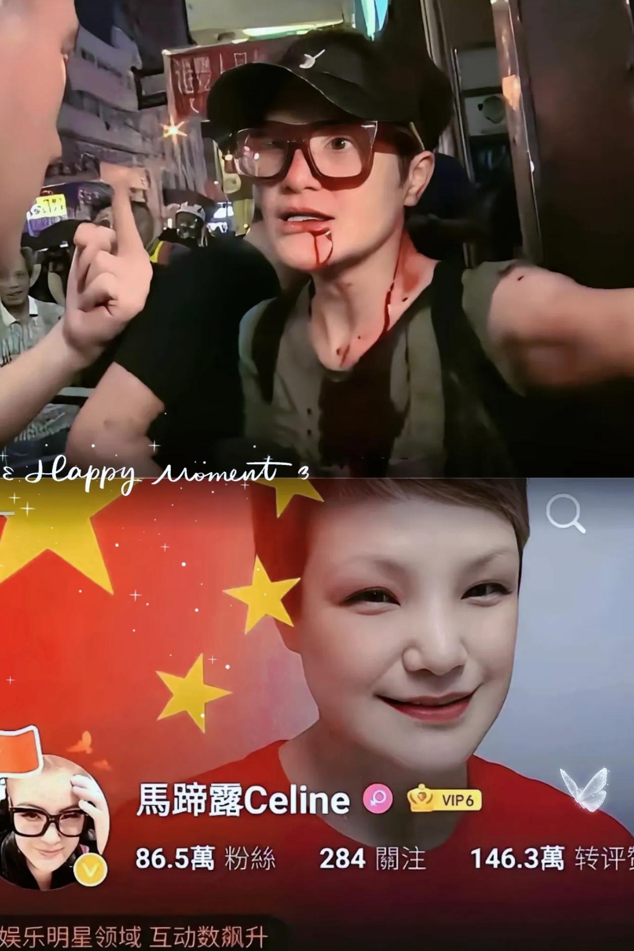 TVB“丑角专业户”马蹄露这次直接掀了桌子！张敬轩靠道歉翻篇拿