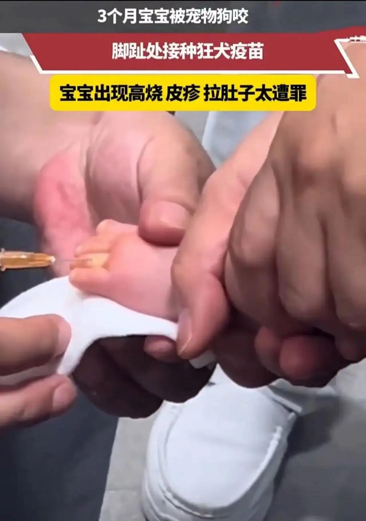 狗不咬人？三个月大婴儿被自家狗咬成重伤，网友：这下打脸了吧“我家狗不咬人”——
