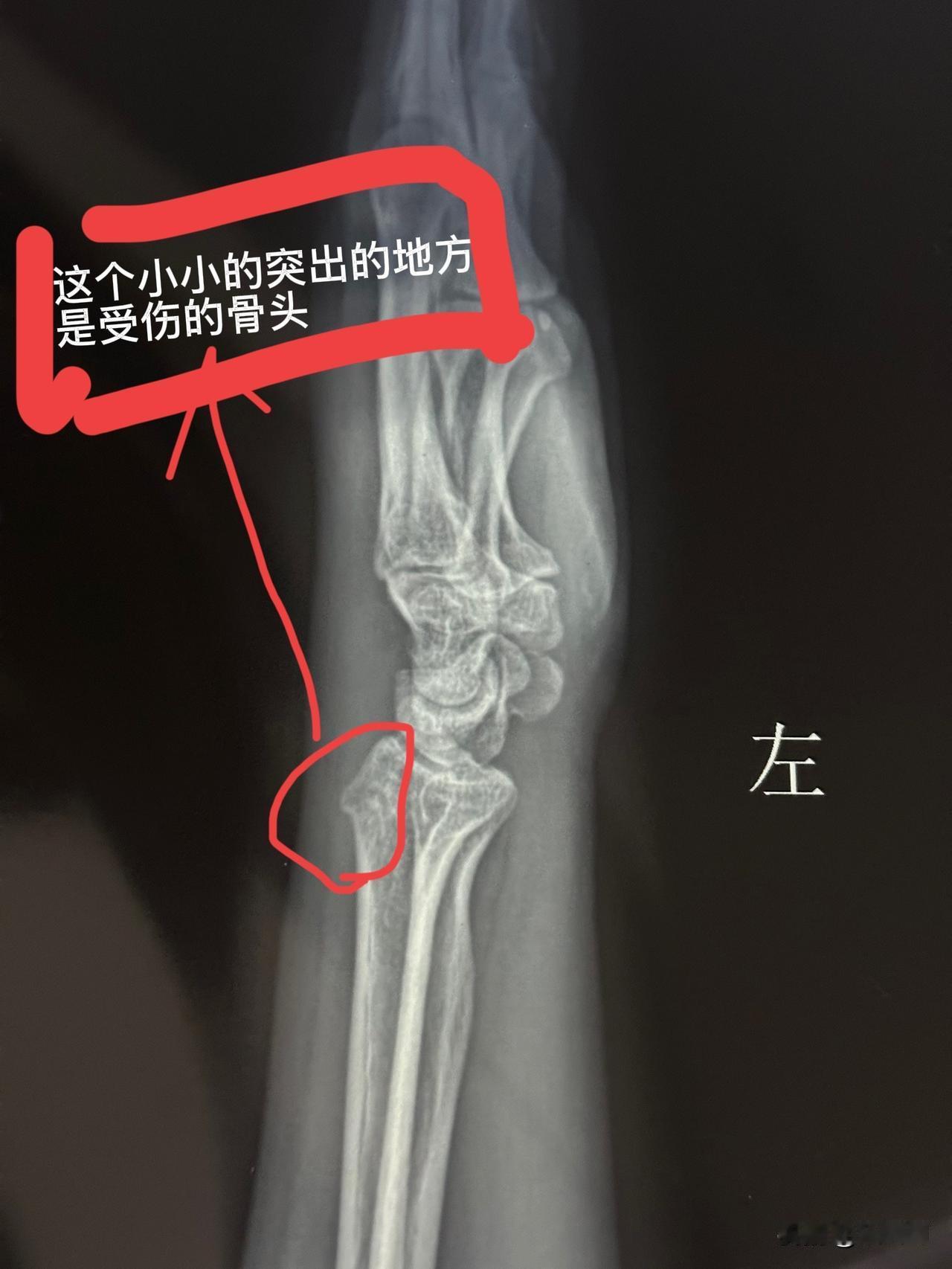 千万要接受教训！年龄大点的人一定要注意了懒就懒些，不要太勤快上周三上午我