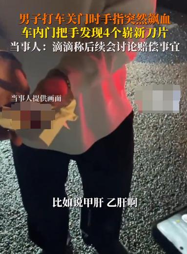 “简直太坏了！”成都，一名男子呼叫滴滴乘车，他上车关门时，感觉手被电了一下，手指