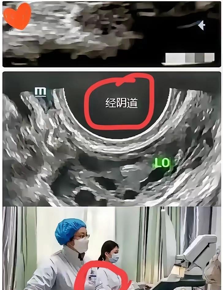 苏州这事儿，简直震碎三观！王女士近日因为身体不适，去苏州市立医院东区做了一个腹