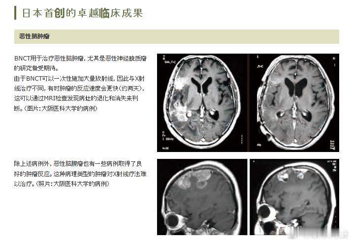 日本癌症突破性技术向中国开放一本正经地胡说八道，把“之一”说得很弱声，后面近乎吹