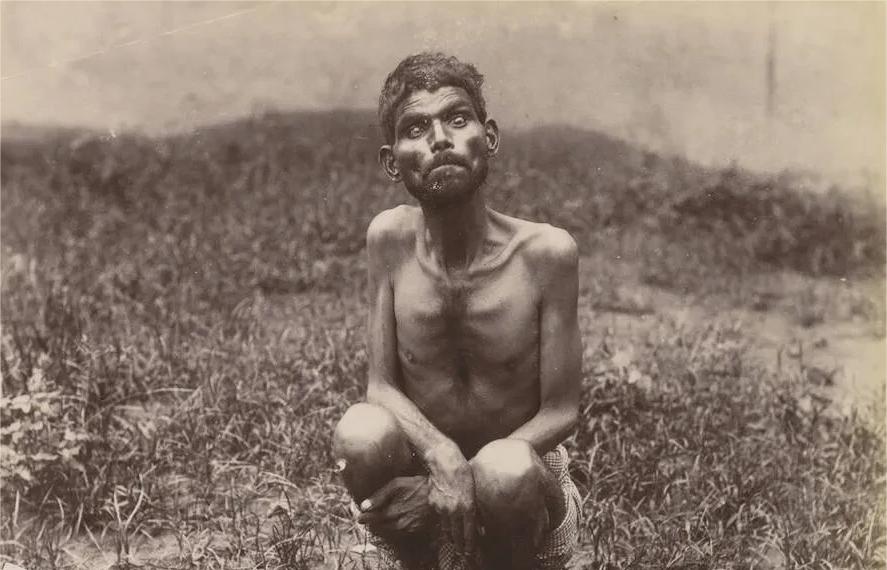 1867年，一个大约6岁的小男孩在狼窝里被人们发现，他像狼一样嚎叫和行走，被狼养