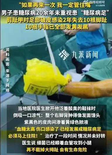 “可惜没有后悔药！”10月14日浙江icon一男子剪脚指甲，不慎剪破拇趾边缘，出