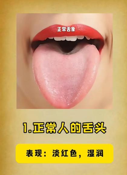 8种舌象，中医大总结~