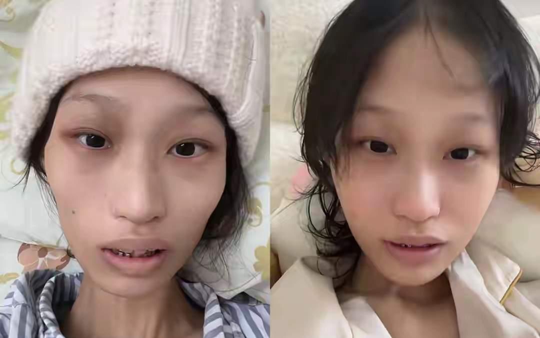 太可惜了！“勇敢饭饭”如果曾经没有被误诊2年，这条命是不是就不会丢？2年