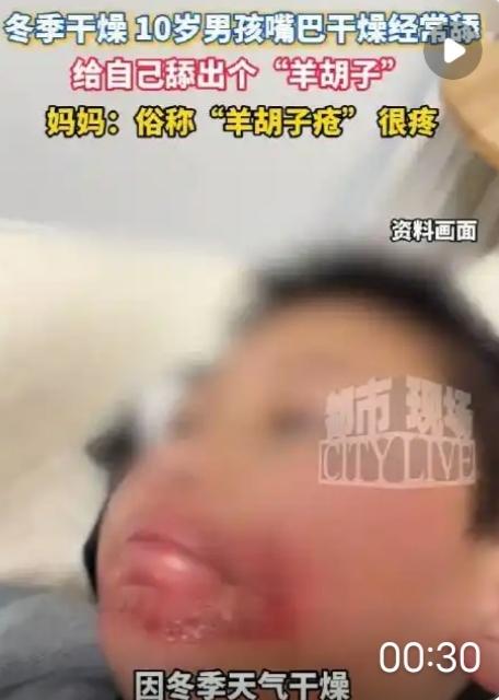 安徽10岁男孩的“羊胡子疮”，乍一看是个小毛病，却戳中了无数家长的隐秘焦虑——你