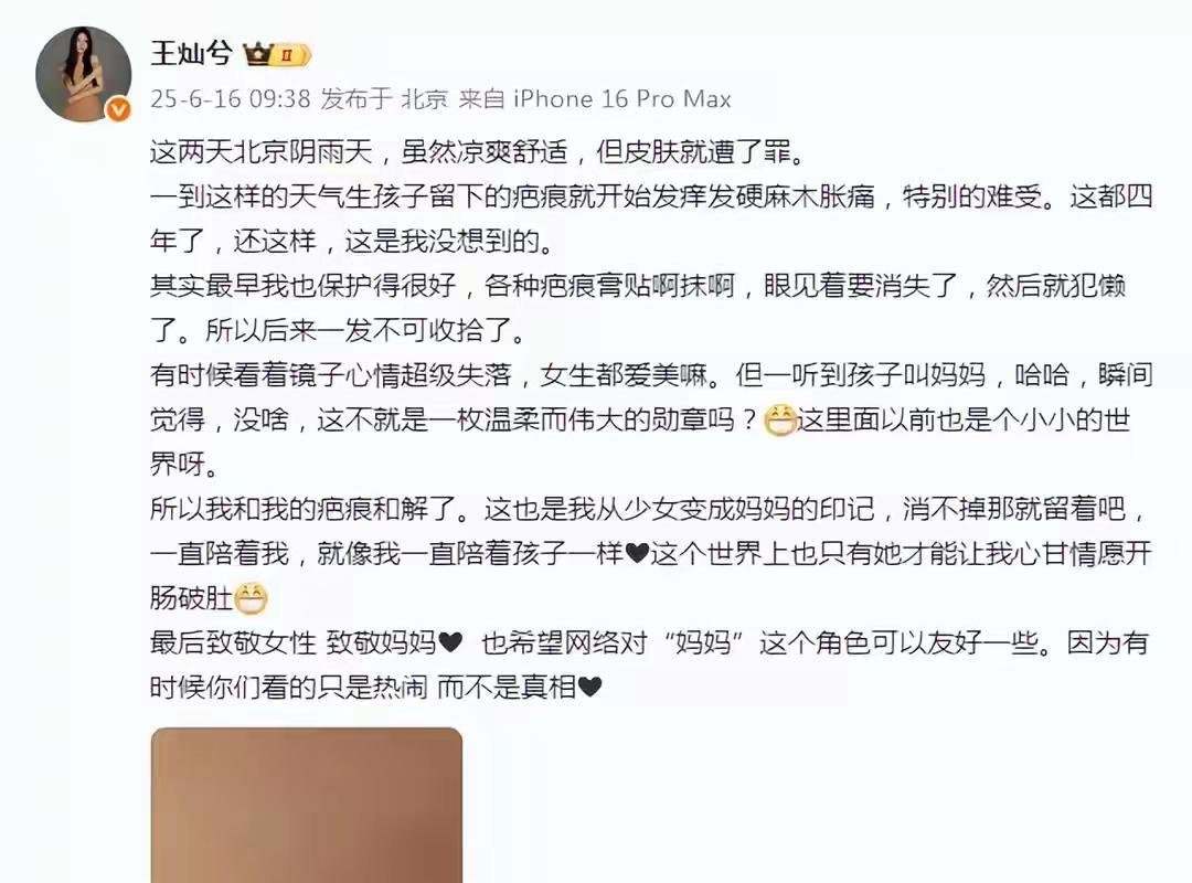 那道剖腹产疤痕是母爱的勋章！王灿晒产后真实疤痕自述心路历程，与身体和解的勇气看哭网友