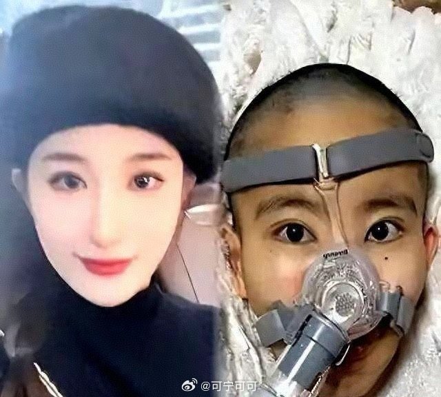 痛心！26岁湖南女孩陈静雯确诊渐冻症后不幸离世，从发病到离开仅短短数月，生命脆弱