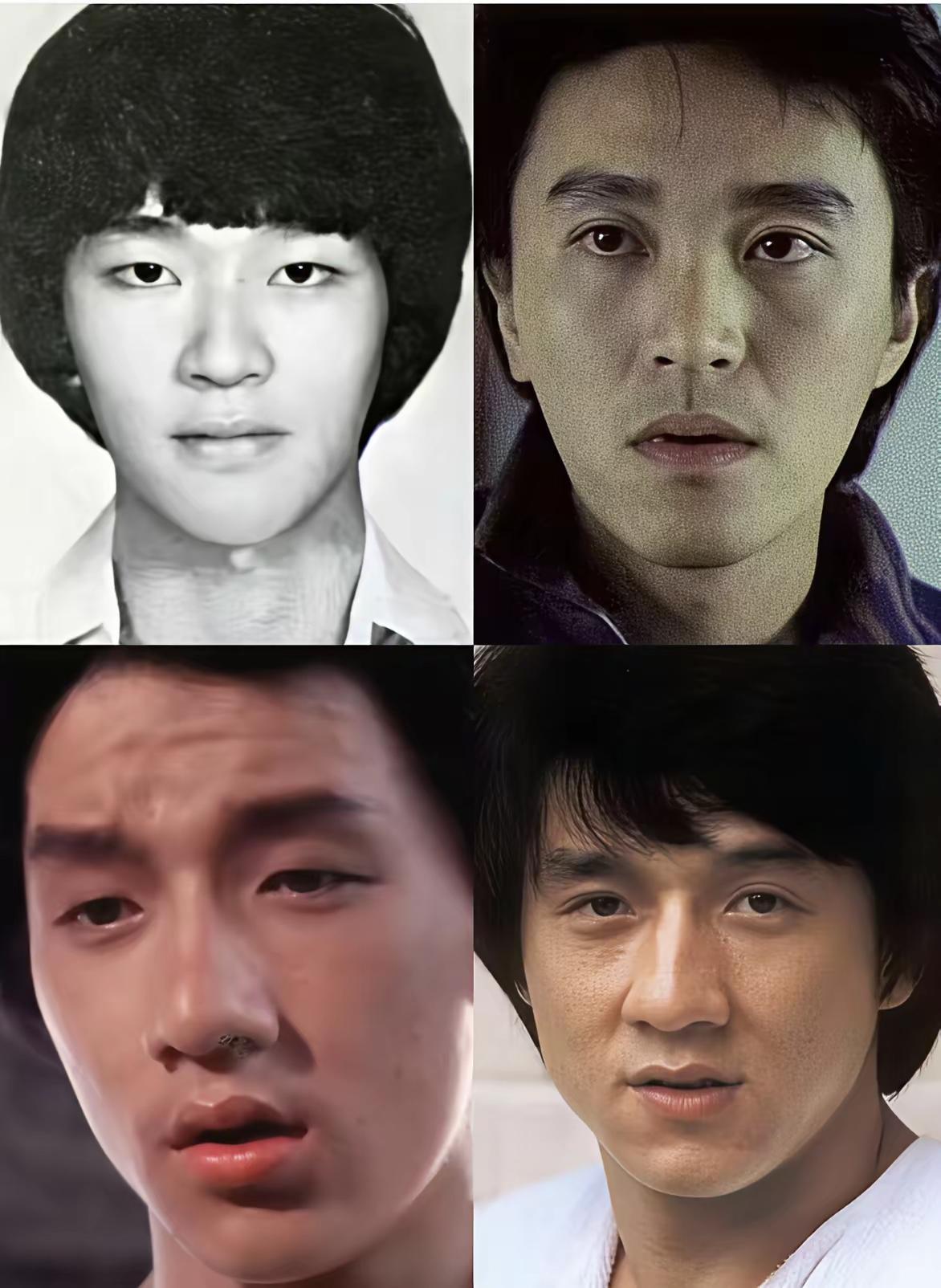 以前医美技术挺好的，像周星驰和成龙这双眼皮弄的非常自然，就像天生就是这样的。