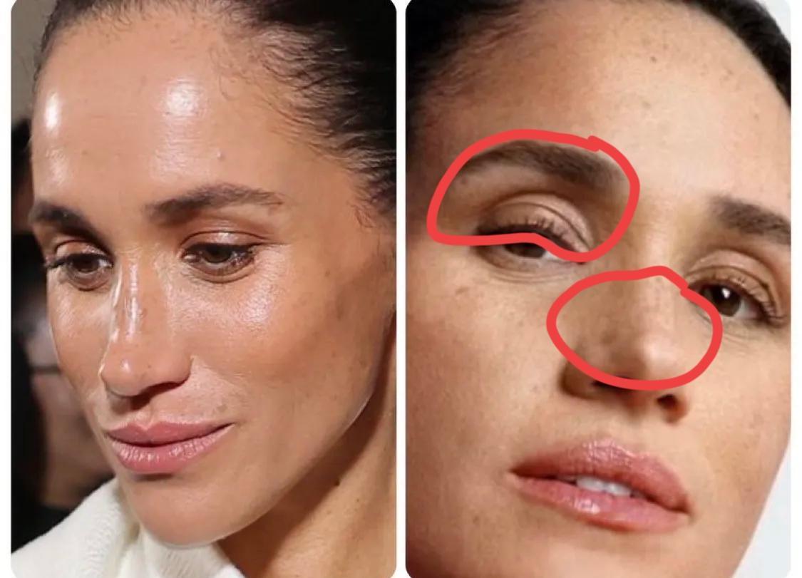 梅根这眼和鼻子，变化是真不小呀！这几年梅根，几乎隔一段时间就有想“异动”，不单