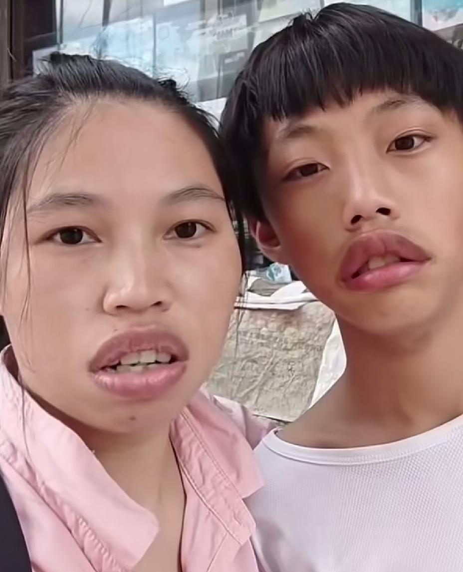 女子晒出儿子女儿的照片，基因太强大了，整张脸全毁在一张嘴上。